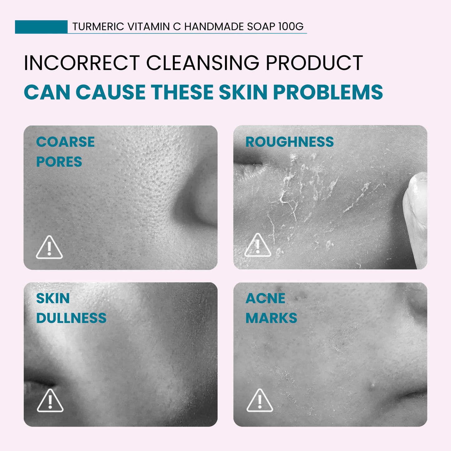 TurmiPure™ Turmeric Soap