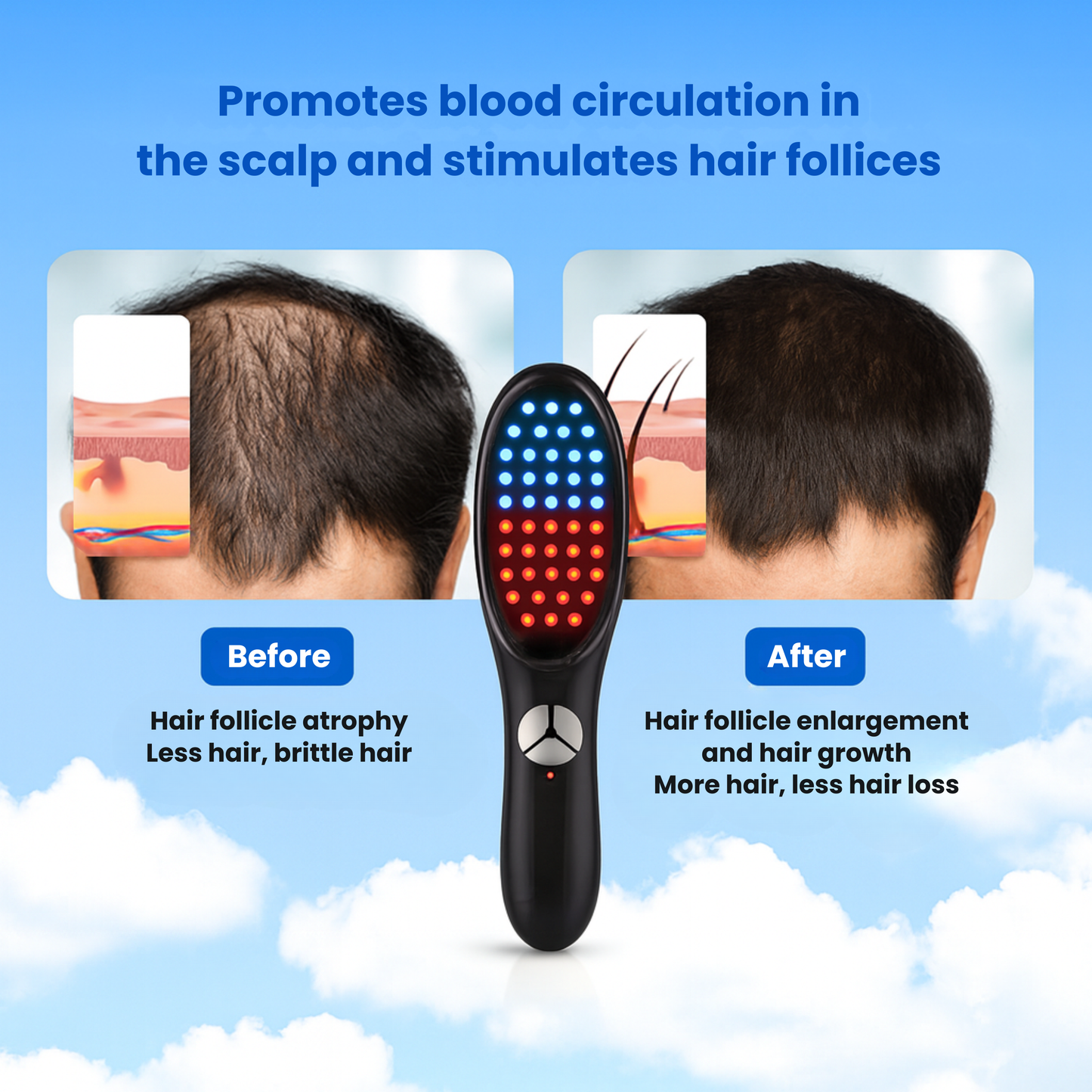 VitaComb™ Therapy Brush